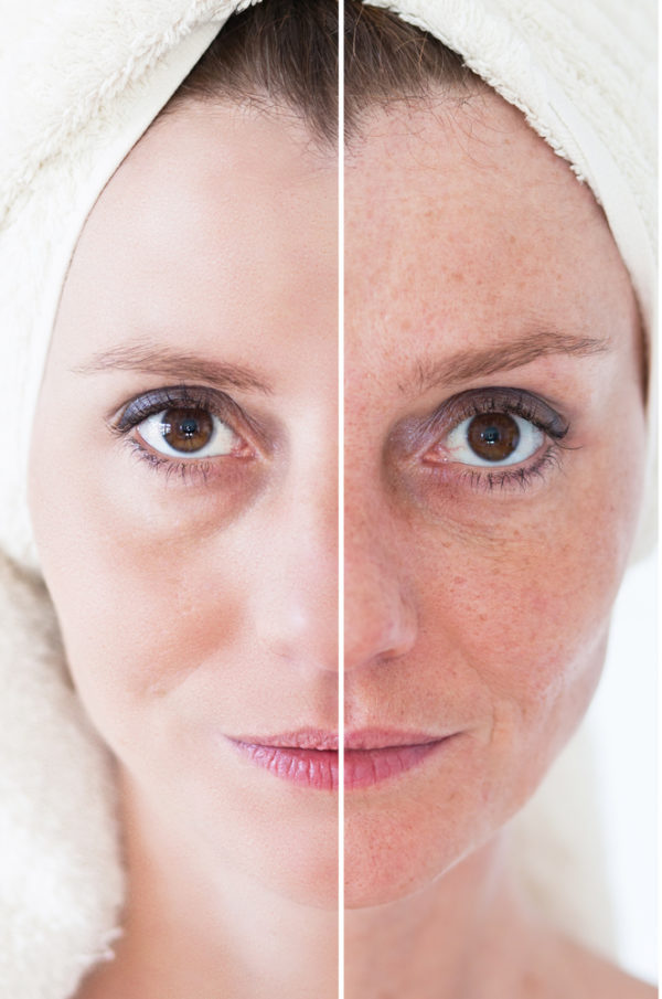 Age Spots … Cause, Prevention & Treatment | Skincare Products - Facial ...